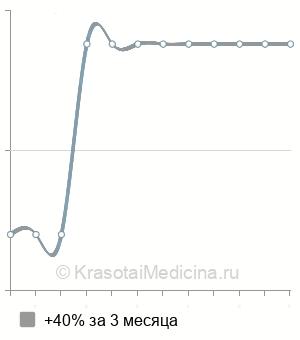 Средняя стоимость флюоресцеиновая инстилляционная проба в Саратове