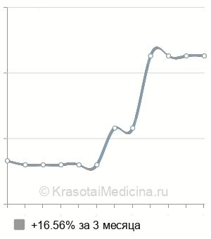 Средняя стоимость подбор контактных линз в Саратове